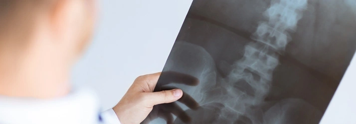 A person holding and examining an X‑ray image of a spine